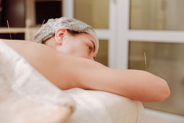 Acupuncture pour douleurs musculo-squelettiques à Balma